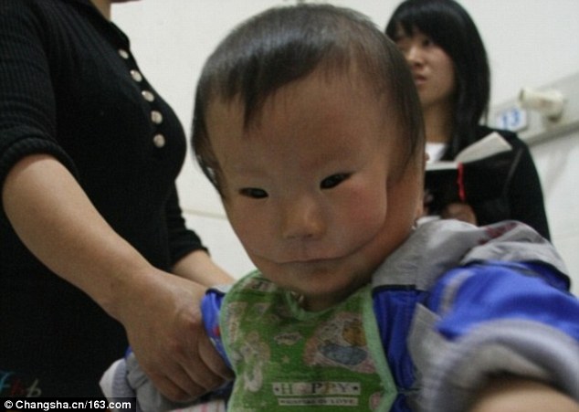 3c12452300000578-0-the_child_born_inchina_s_hunan_province_suffered_from_a_severe_t-a-35_1484220370140